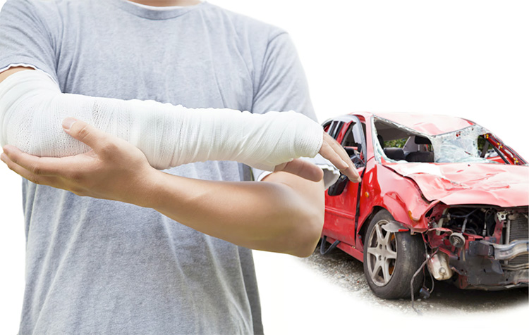 Common Car Accident Injuries